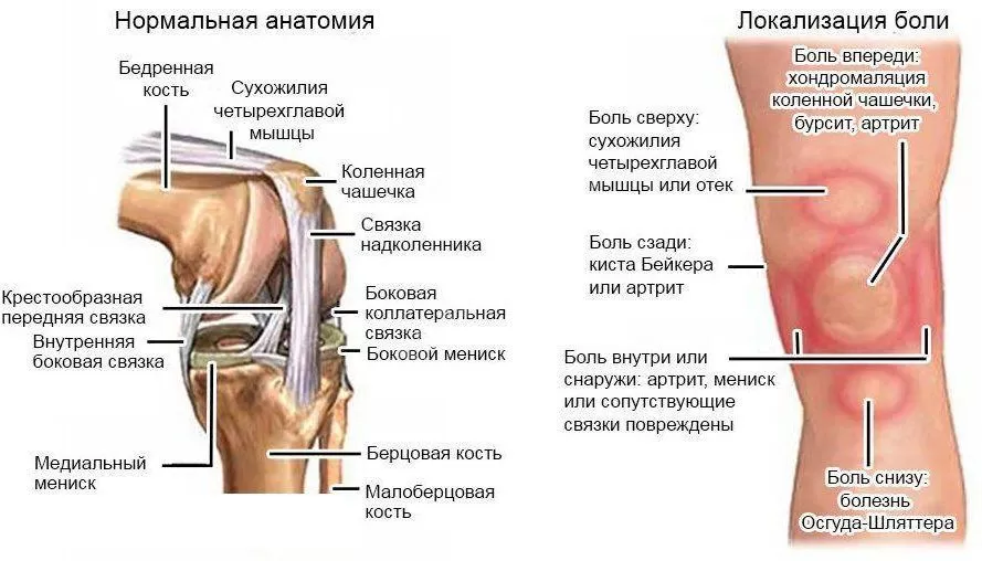 Боль в колене после тренировки